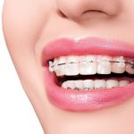 Bài viết demo số 8